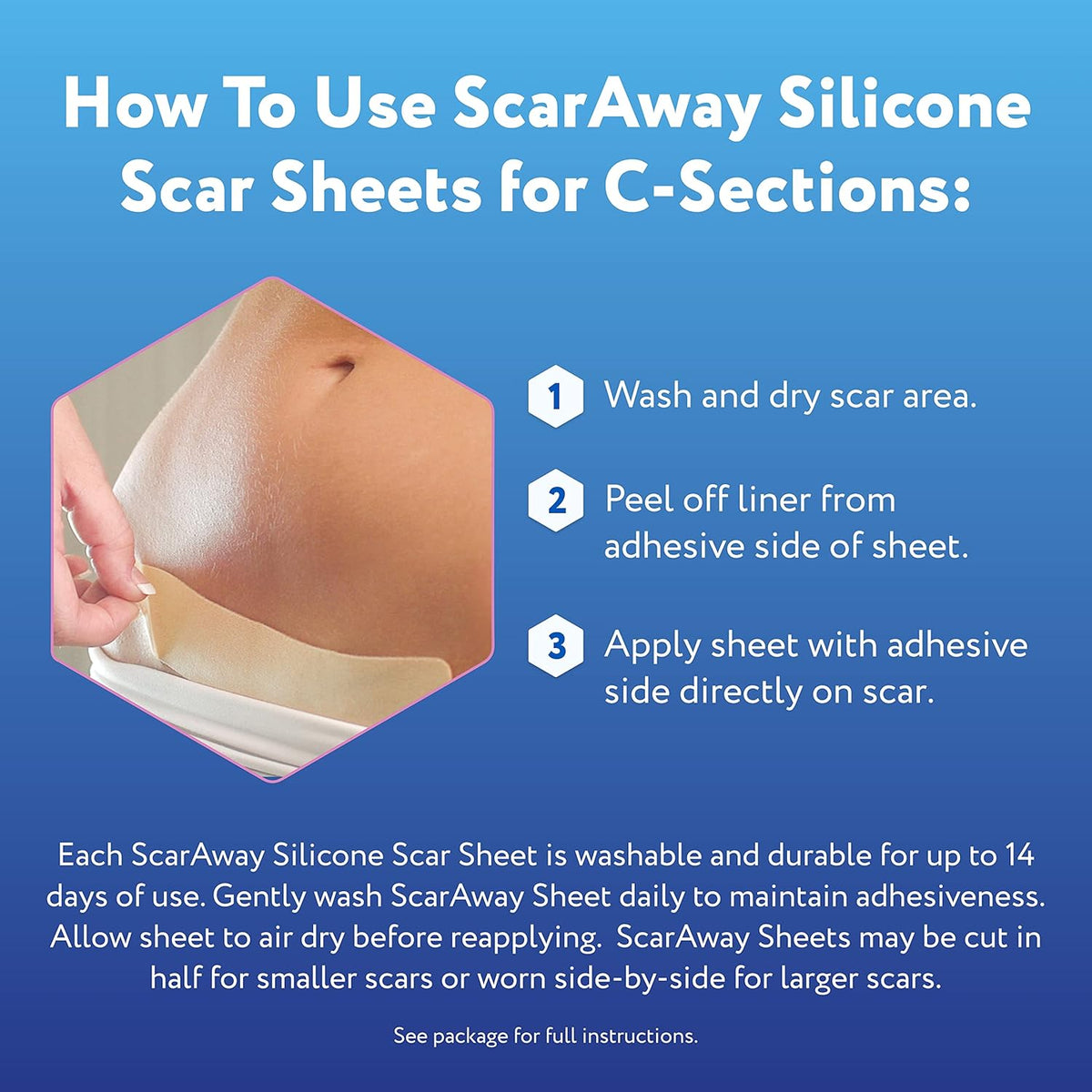 Reusable Silicone Scar Sheets (1.5” x 7”), 4 Sheets J60931