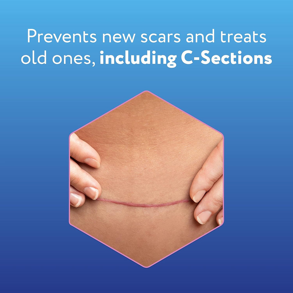 Reusable Silicone Scar Sheets (1.5” x 7”), 4 Sheets J60931